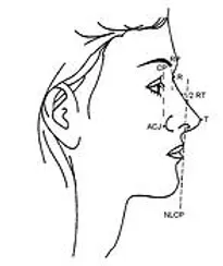 The profile of the nose