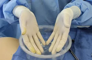gloves thoroughly with an antibiotic solution before handling the implant