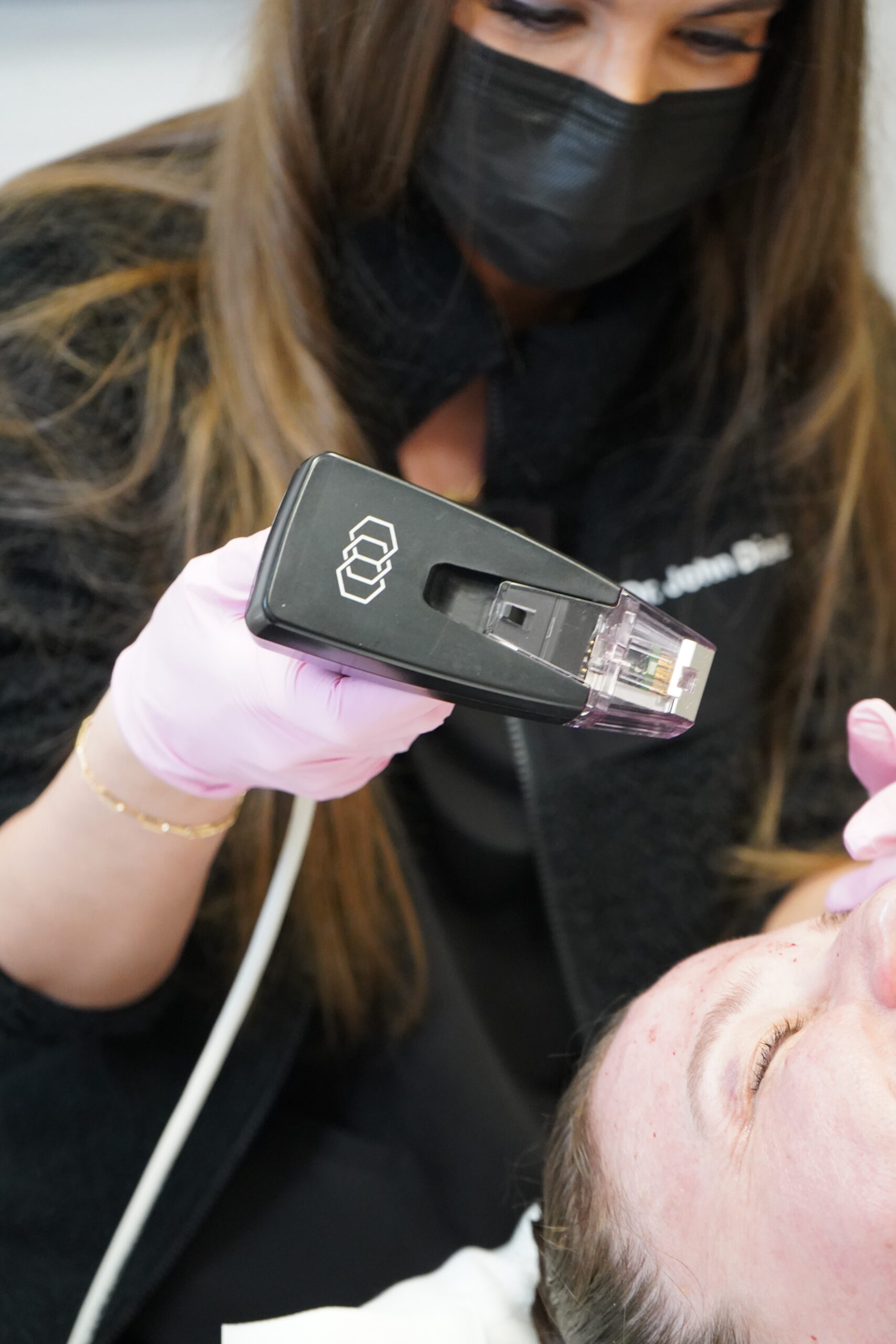 patient receiving morpheus8 treatment in beverly hills, ca