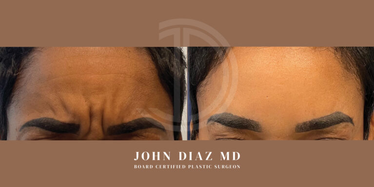 Dr John Diaz Medspa services - Botox