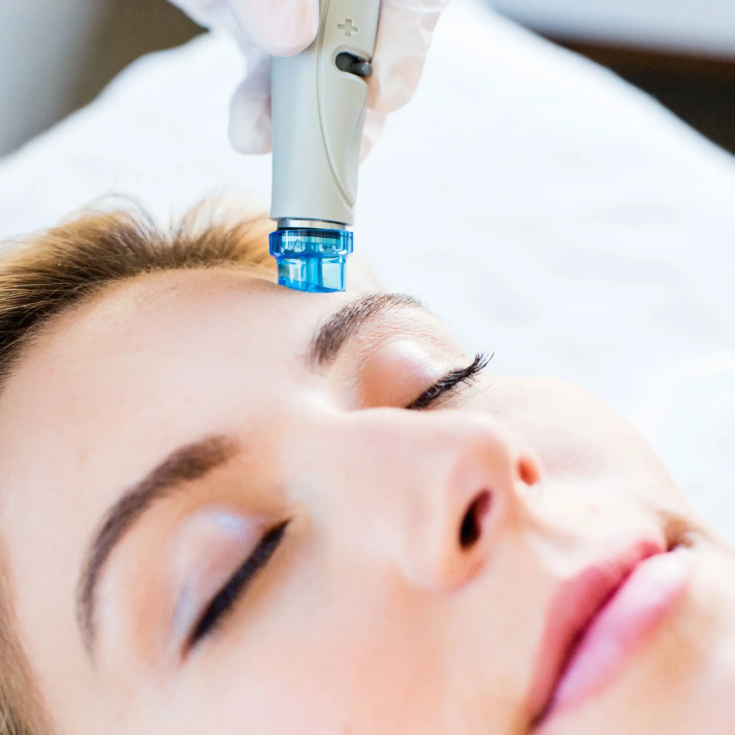hydrafacial beverly hills ca
